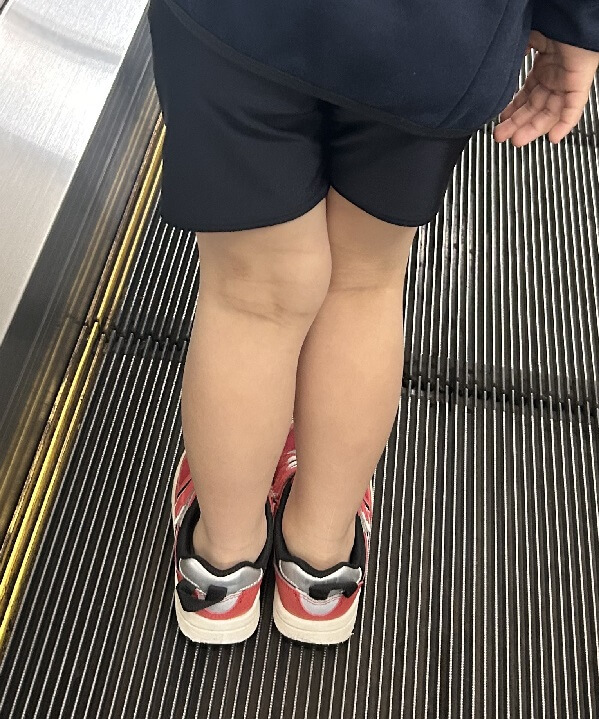 足をそろえても膝が重なる